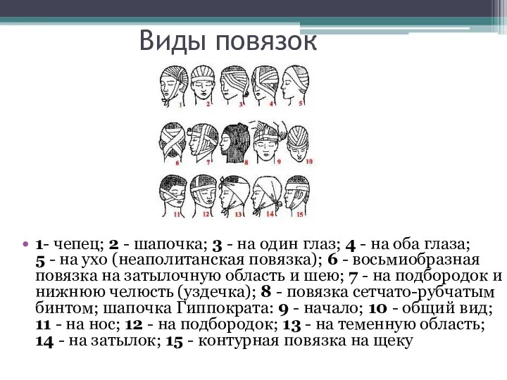 Виды повязок 1- чепец; 2 - шапочка; 3 - на один глаз;