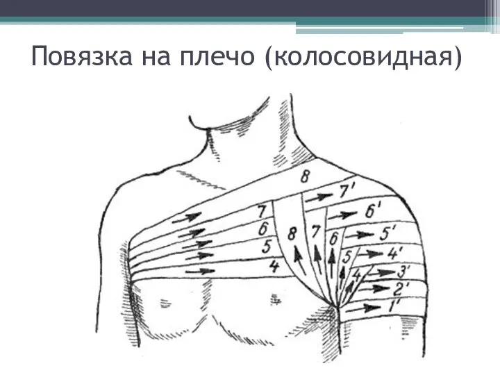 Повязка на плечо (колосовидная)