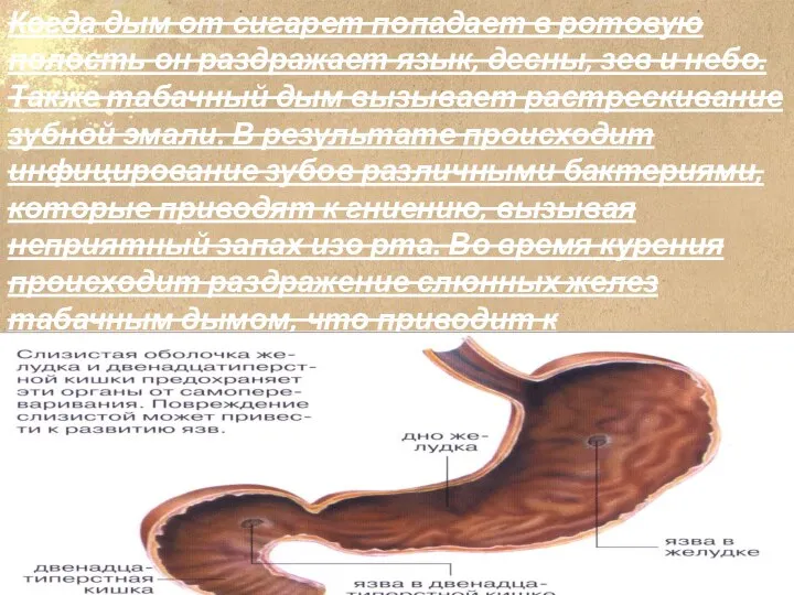 Когда дым от сигарет попадает в ротовую полость он раздражает язык, десны,