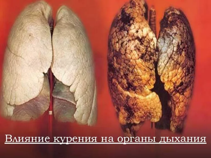 Влияние курения на органы дыхания