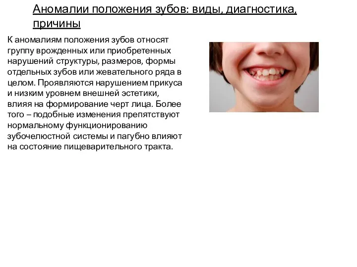 Аномалии положения зубов: виды, диагностика, причины К аномалиям положения зубов относят группу