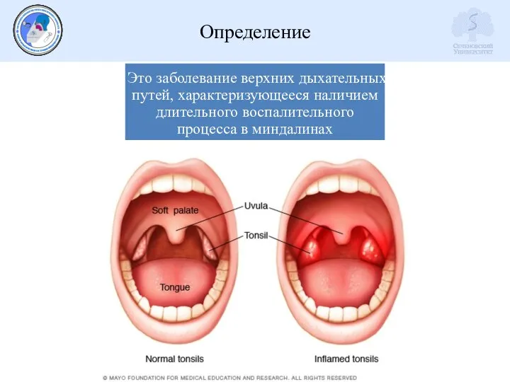 Определение