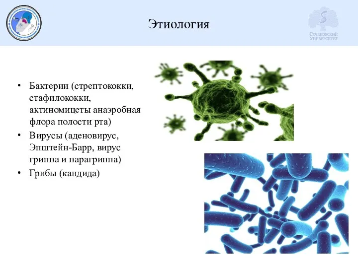 Этиология Бактерии (стрептококки, стафилококки, актиномицеты анаэробная флора полости рта) Вирусы (аденовирус, Эпштейн-Барр,