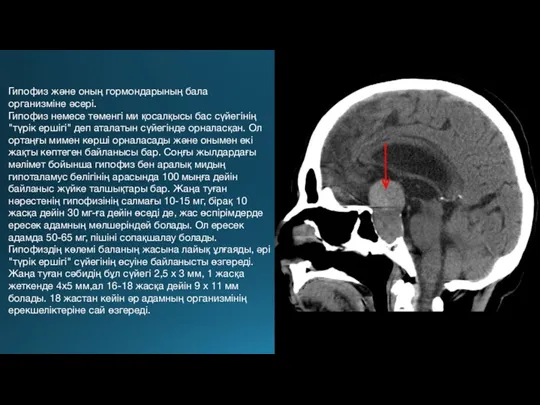 Гипофиз және оның гормондарының бала организміне әсері. Гипофиз немесе төменгі ми қосалқысы