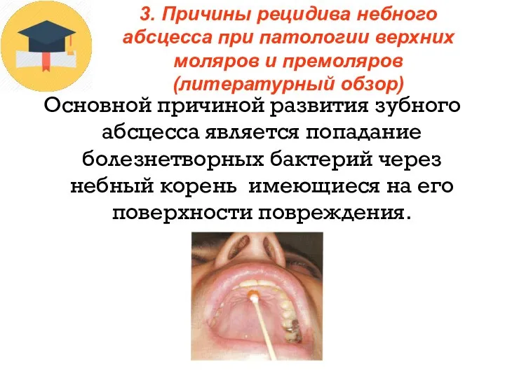 Основной причиной развития зубного абсцесса является попадание болезнетворных бактерий через небный корень
