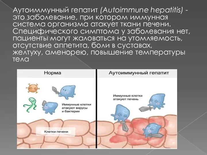 Аутоиммунный гепатит (Autoimmune hepatitis) - это заболевание, при котором иммунная система организма