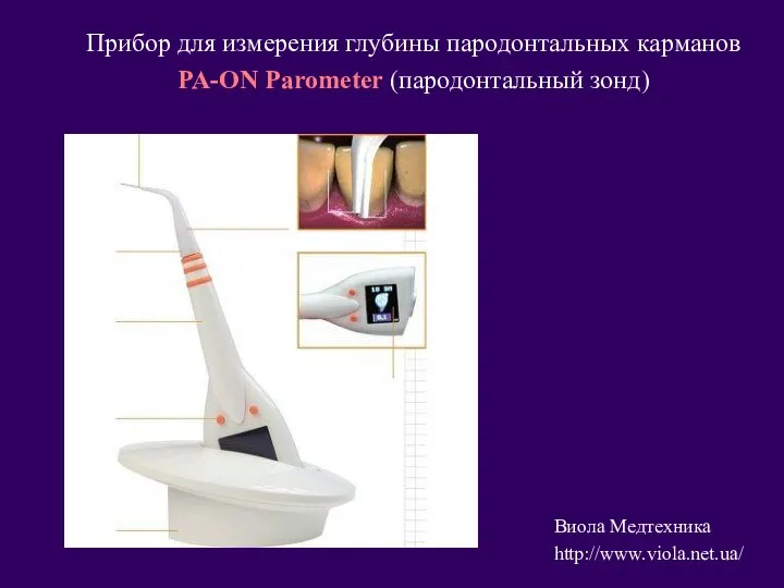 Прибор для измерения глубины пародонтальных карманов PA-ON Parometer (пародонтальный зонд) Виола Медтехника http://www.viola.net.ua/