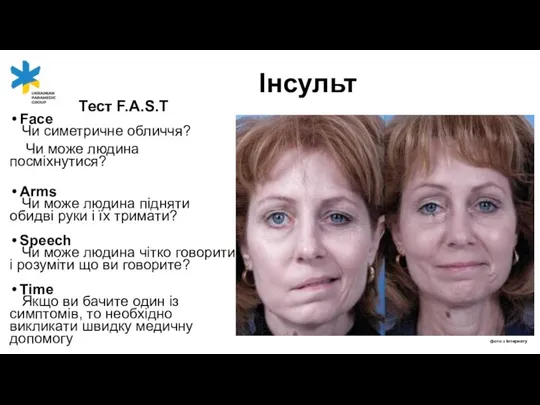 Тест F.A.S.T Face Чи симетричне обличчя? Чи може людина посміхнутися? Arms Чи