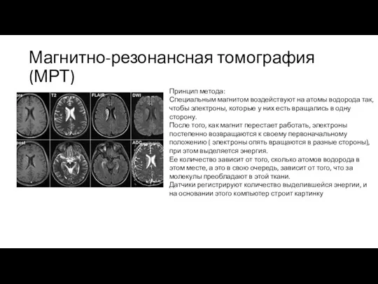 Магнитно-резонансная томография (МРТ) Принцип метода: Специальным магнитом воздействуют на атомы водорода так,