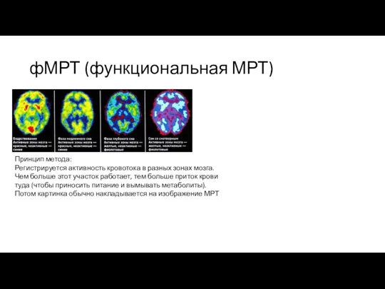 фМРТ (функциональная МРТ) Принцип метода: Регистрируется активность кровотока в разных зонах мозга.