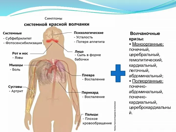 Волчаночные кризы: • Моноорганные: почечный, церебральный, гемолитический, кардиальный, легочный, абдоминальный; • Полиорганные: почечно-абдоминальный, почечно-кардиальный, цереброкардиальный.