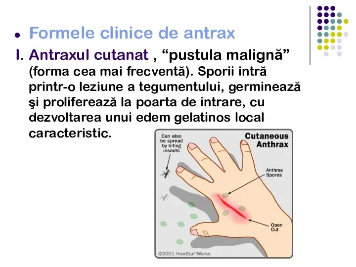 Formele clinice de antrax I. Antraxul cutanat , “pustula malignă” (forma cea