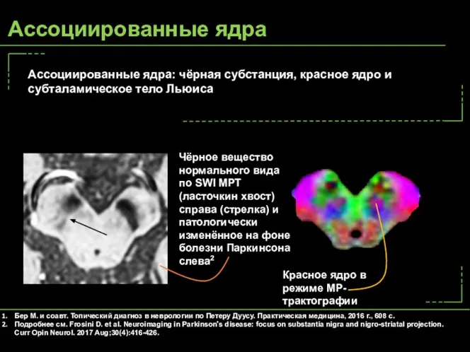 Ассоциированные ядра: чёрная субстанция, красное ядро и субталамическое тело Льюиса Чёрное вещество