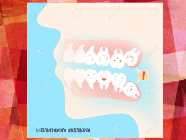 Dientes de sabiduría