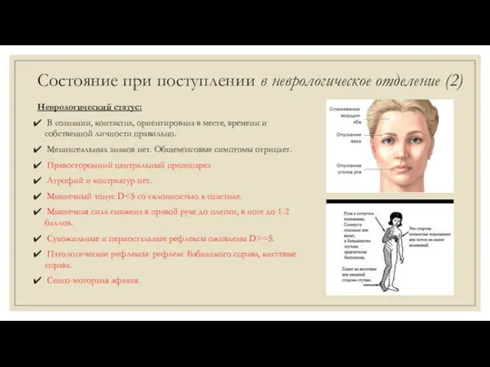 Состояние при поступлении в неврологическое отделение (2) Неврологический статус: В сознании, контактна,