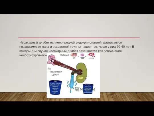 Несахарный диабет является редкой эндокринопатией, развивается независимо от пола и возрастной группы