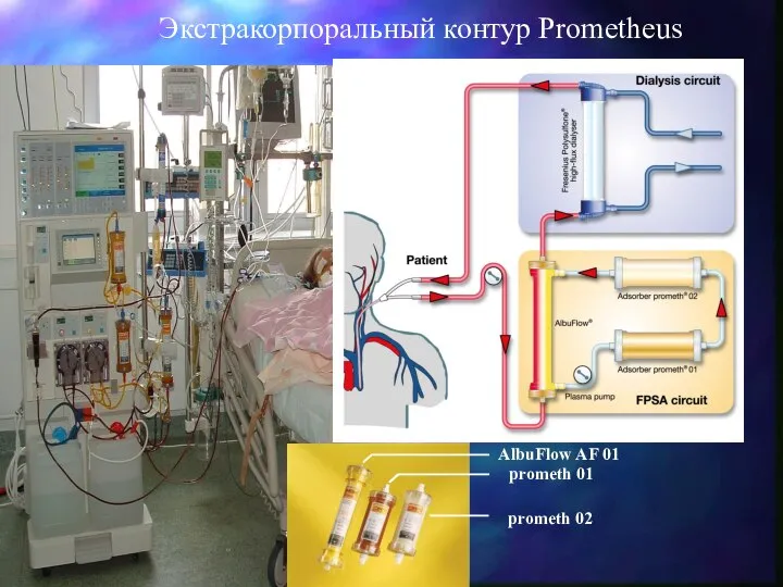 Экстракорпоральный контур Prometheus