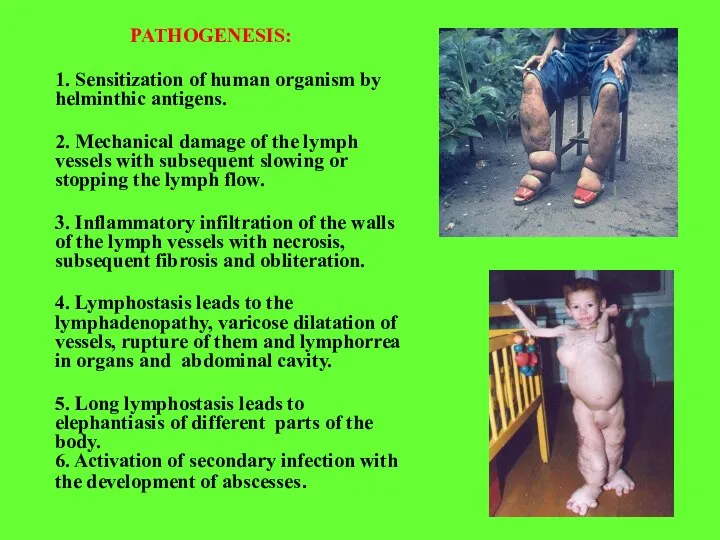 PATHOGENESIS: 1. Sensitization of human organism by helminthic antigens. 2. Mechanical damage