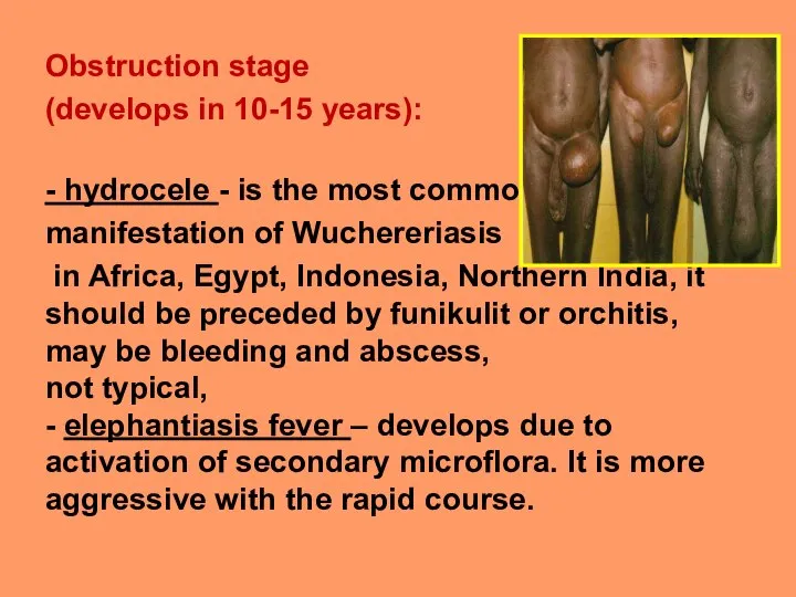 Obstruction stage (develops in 10-15 years): - hydrocele - is the most