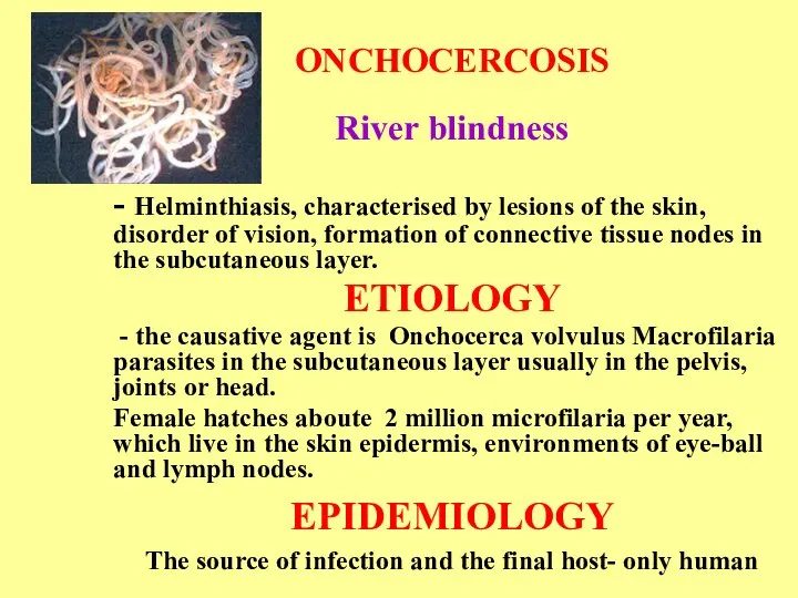 ONCHOCERCOSIS River blindness - Helminthiasis, characterised by lesions of the skin, disorder