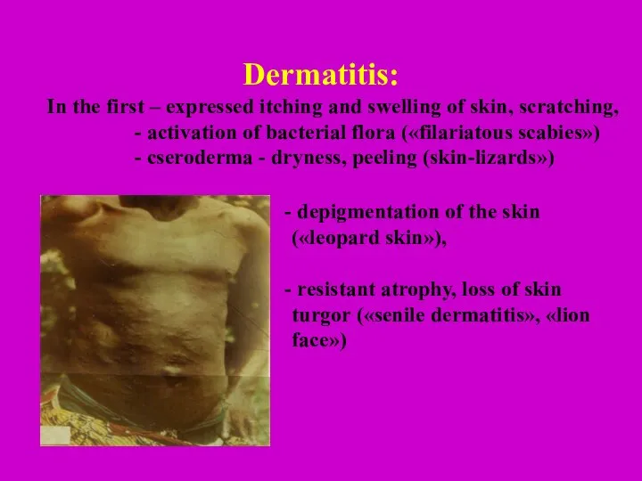 Dermatitis: In the first – expressed itching and swelling of skin, scratching,