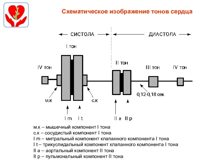 Схематическое изображение тонов сердца м.к – мышечный компонент I тона с.к –