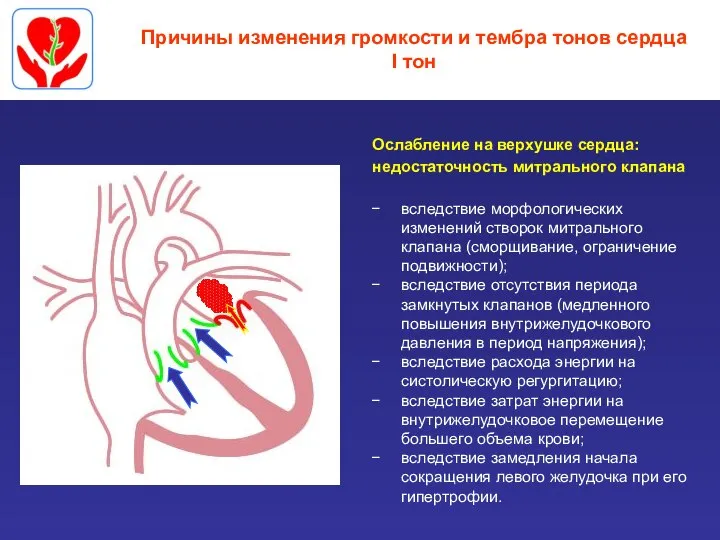 Причины изменения громкости и тембра тонов сердца I тон Ослабление на верхушке