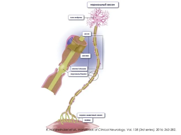 R. Hanewinckel et al., Handbook of Clinical Neurology, Vol. 138 (3rd series), 2016: 263-282.