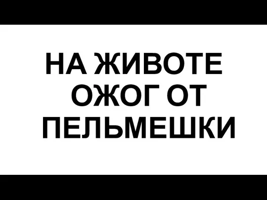 НА ЖИВОТЕ ОЖОГ ОТ ПЕЛЬМЕШКИ