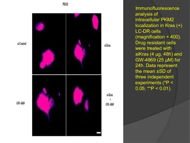 Immunofluorescence analysis of intracellular PKM2 localization in Kras (+) LC-DR cells (magnification