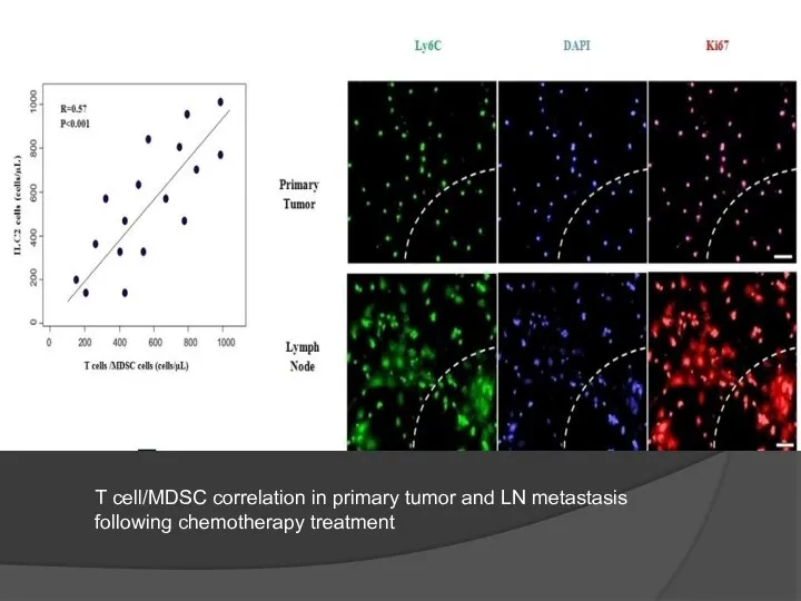 T cell/MDSC correlation in primary tumor and LN metastasis following chemotherapy treatment