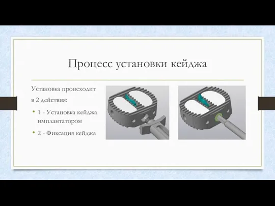 Процесс установки кейджа Установка происходит в 2 действия: 1 - Установка кейджа