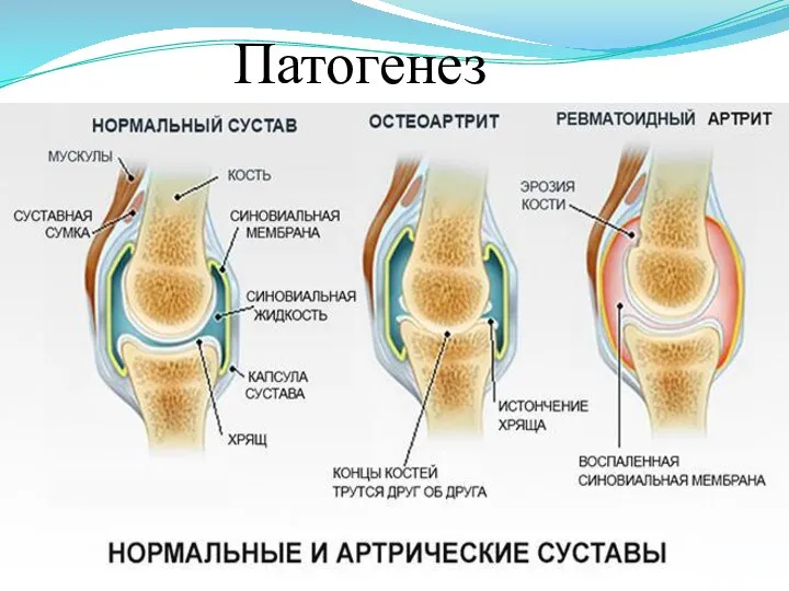 Патогенез