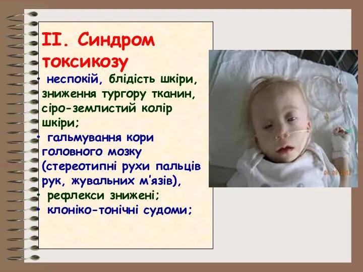 II. Синдром токсикозу неспокій, блідість шкіри, зниження тургору тканин, сіро-землистий колір шкіри;