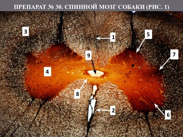 ПРЕПАРАТ № 30. СПИННОЙ МОЗГ СОБАКИ (РИС. 1) 1 2 3 4