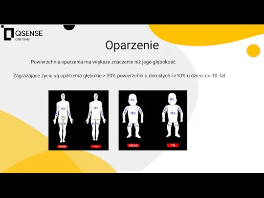 Oparzenie Powierzchnia oparzenia ma większe znaczenie niż jego głębokość Zagrażające życiu są