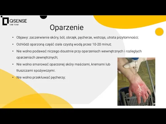 Objawy: zaczerwienie skóry, ból, obrzęk, pęcherze, wstrząs, utrata przytomności; Ochłódź oparzoną część