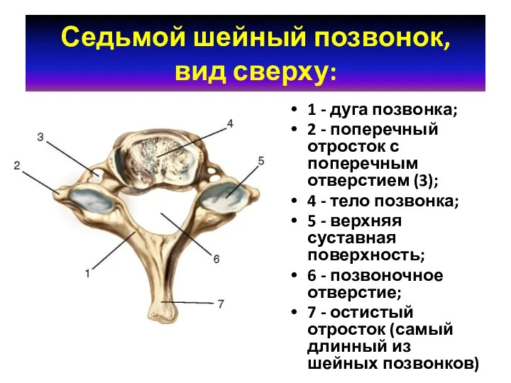 Седьмой шейный позвонок, вид сверху: 1 - дуга позвонка; 2 - поперечный