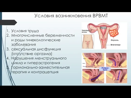 Условия возникновения ВРВМТ Условия труда Многочисленные беременности и роды гинекологические заболевания сексуальная