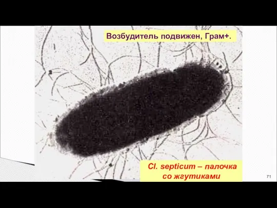 Cl. septicum – палочка со жгутиками Возбудитель подвижен, Грам+.