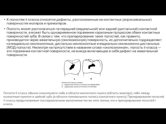 К полостям II класса относятся дефекты, расположенные на контактных (апроксимальных) поверхностях моляров