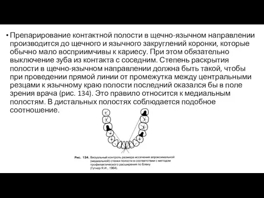 Препарирование контактной полости в щечно-язычном направлении производится до щечного и язычного закруглений