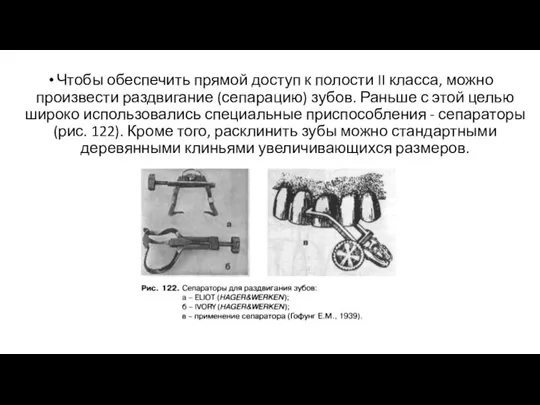 Чтобы обеспечить прямой доступ к полости II класса, можно произвести раздвигание (сепарацию)