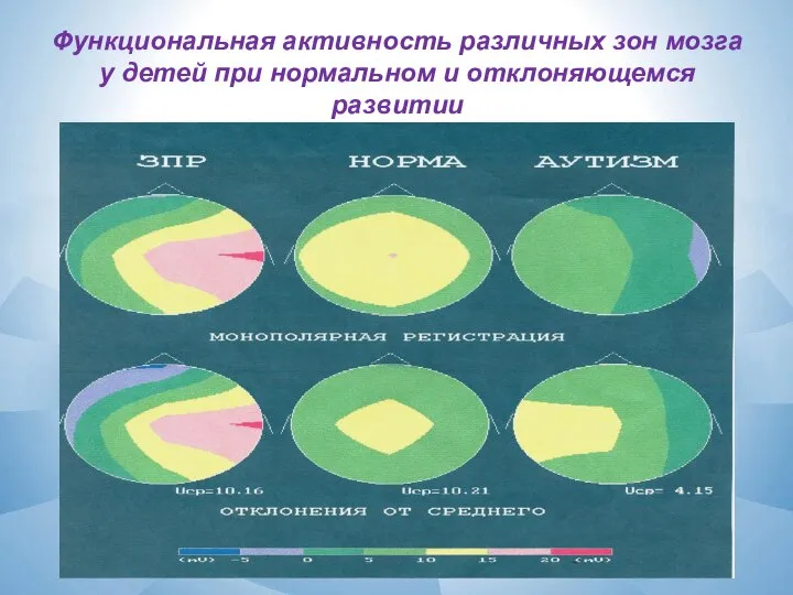 Функциональная активность различных зон мозга у детей при нормальном и отклоняющемся развитии