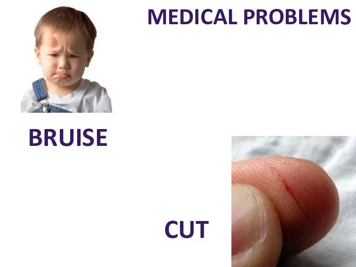 MEDICAL PROBLEMS BRUISE CUT