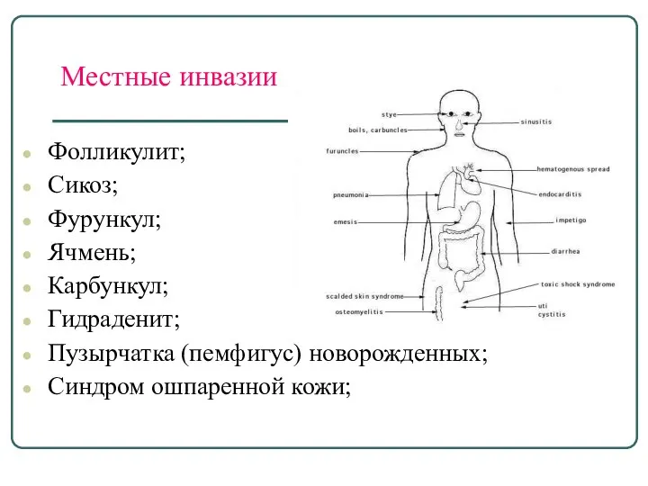 Местные инвазии Фолликулит; Сикоз; Фурункул; Ячмень; Карбункул; Гидраденит; Пузырчатка (пемфигус) новорожденных; Синдром ошпаренной кожи;