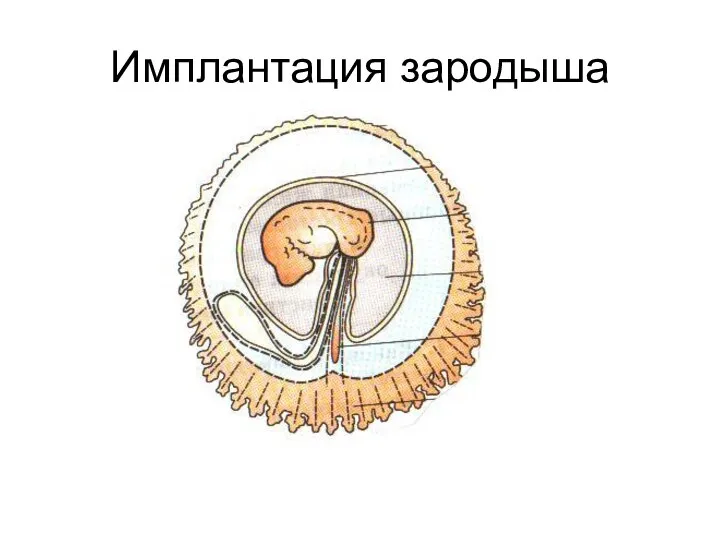Имплантация зародыша