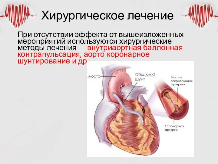 Хирургическое лечение При отсутствии эффекта от вышеизложенных мероприятий используются хирургические методы лечения