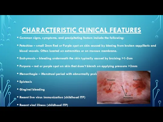 CHARACTERISTIC CLINICAL FEATURES Common signs, symptoms, and precipitating factors include the following: