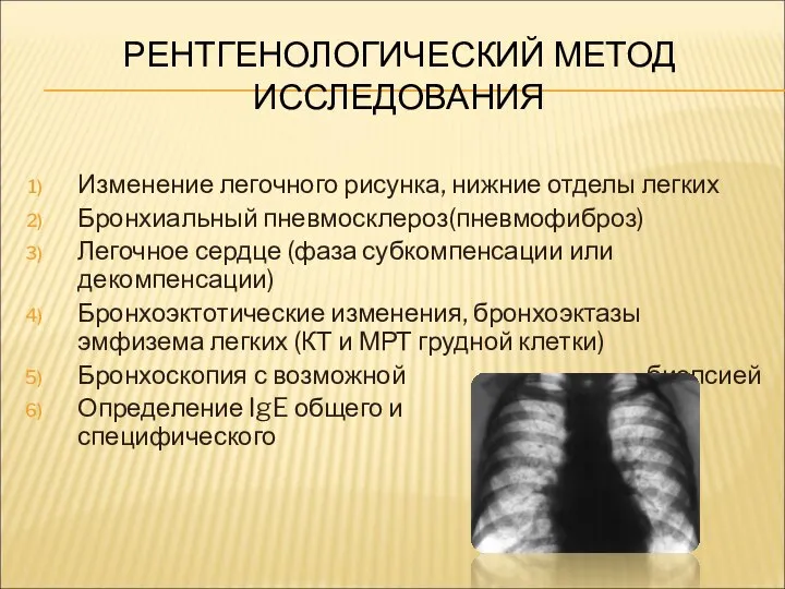 РЕНТГЕНОЛОГИЧЕСКИЙ МЕТОД ИССЛЕДОВАНИЯ Изменение легочного рисунка, нижние отделы легких Бронхиальный пневмосклероз(пневмофиброз) Легочное